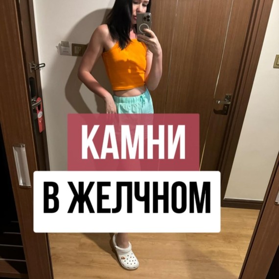 Камни в желчном пузыре и как их предотвратить?