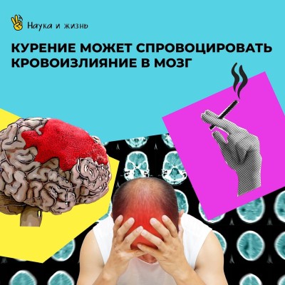 Курение может спровоцировать кровоизлияние в мозг!