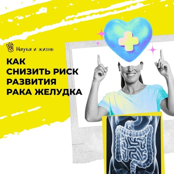 Как снизить риск развития рака желудка?