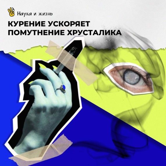 Курение ускоряет помутнение хрусталика