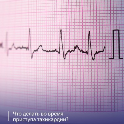 Что делать во время приступа тахикардии?