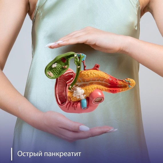 Какие симптомы острого панкреатита?