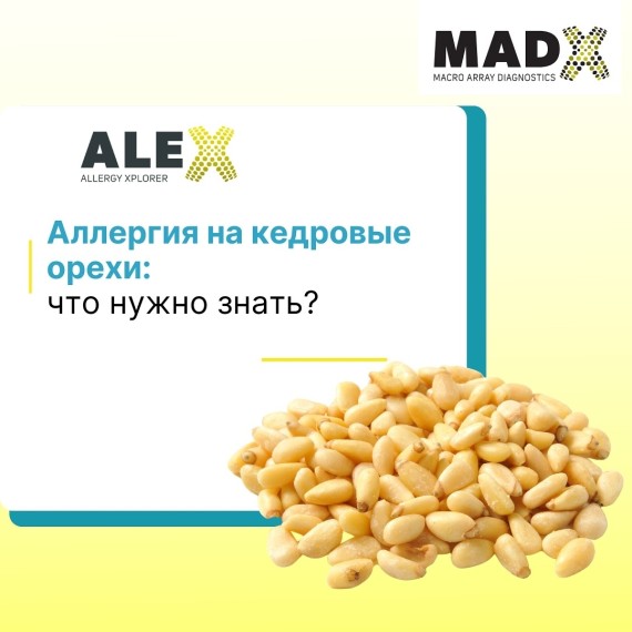 Аллергия на кедровые орехи: что нужно знать