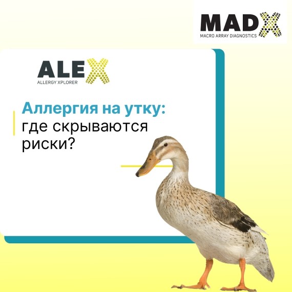 Аллергия на утку: где скрываются риски?