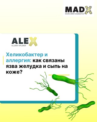 Хеликобактер и аллергия: как связаны язва желудка и сыпь на коже?