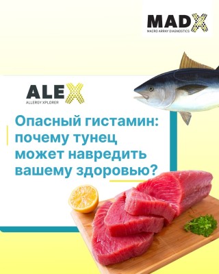 Опасный гистамин: почему тунец может навредить вашему здоровью?