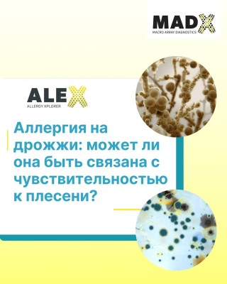 Аллергия на дрожжи: может ли она быть связанна с чувствительностью к плесени?