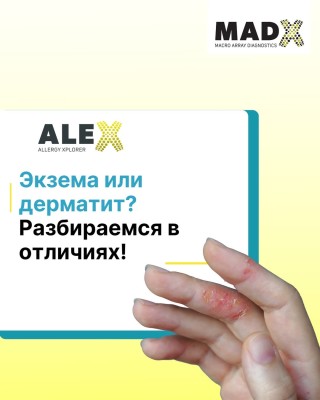 Экзема или дерматит? Разбираемся в отличиях!
