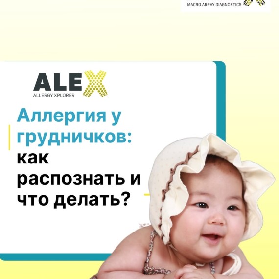 Аллергия у грудничков: как распознать и что делать?