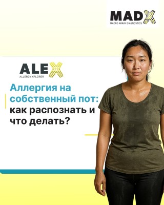 Аллергия на собственный пот: как распознать и что делать?