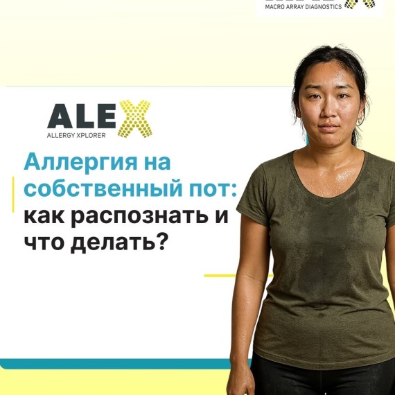 Аллергия на собственный пот: как распознать и что делать?