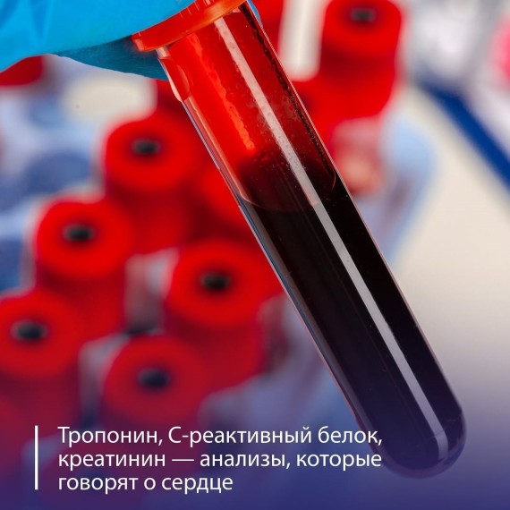 Как понять состояние сердца по анализам крови?