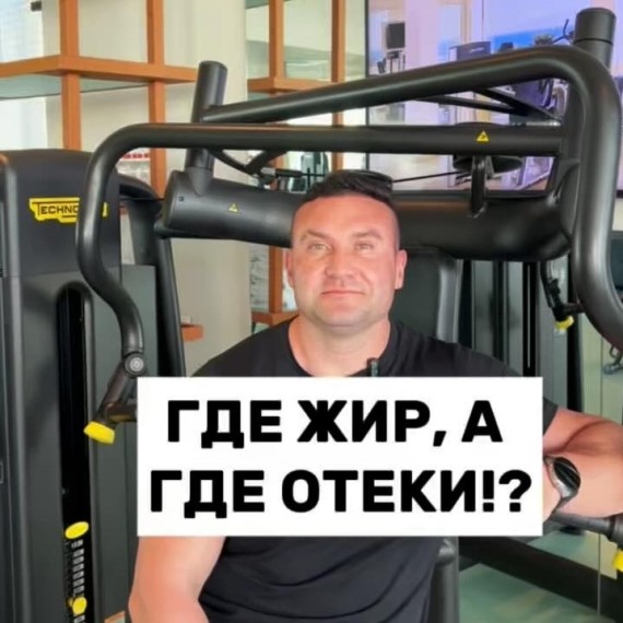 Как жир влияет на отеки?