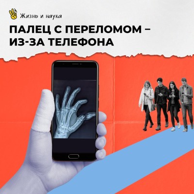 Палец с переломом - из-за телефона