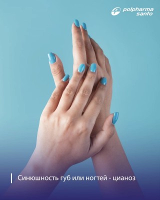 Синюшность губ или ногтей - цианоз