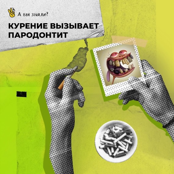 Курение вызывает пародонтит!