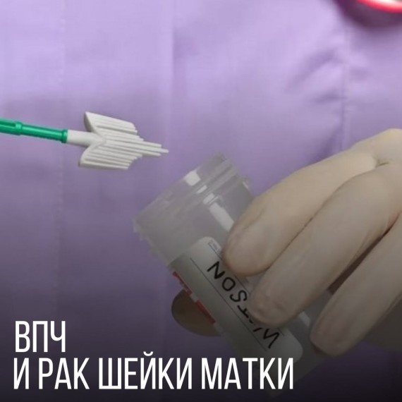 ВПЧ и рак шейки матки
