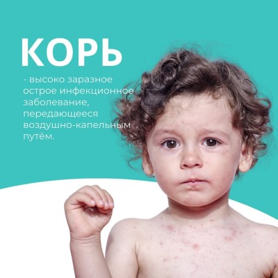 Корь: что это такое, симптомы и лечение