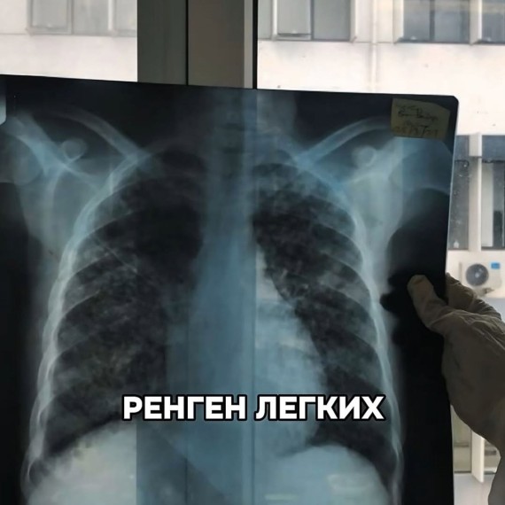 Не подвергайте ребёнка рентгеновскому обследованию без показаний врача!