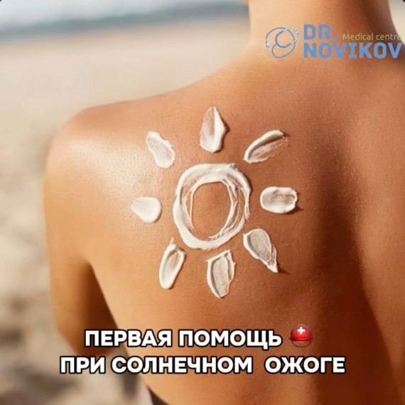 Первая помощь при солнечном ожоге