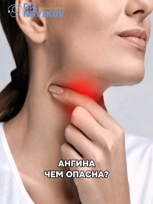 Как отличить ангину от ОРЗ или фарингита?