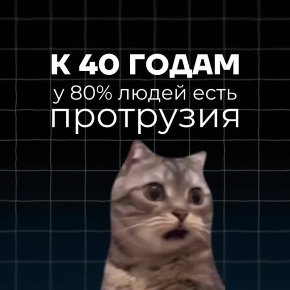 Все ли изменения позвоночника нужно лечить ?
