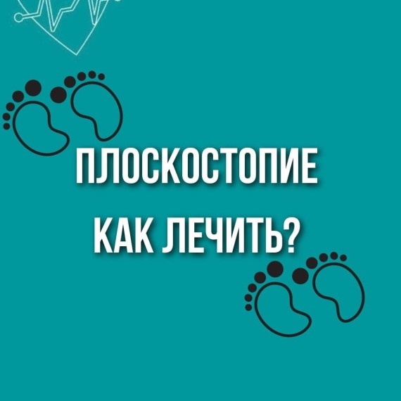 Как лечить плоскостопие?