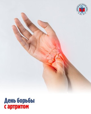 Артрит и его основные признаки