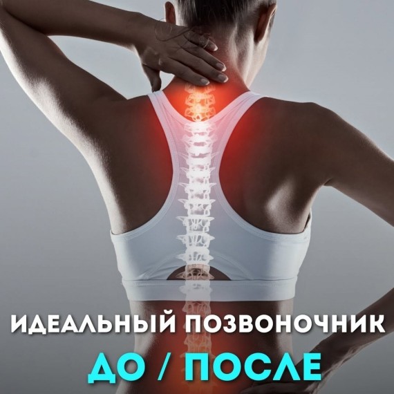  Как изменяется осанка после лечения сколиоза?