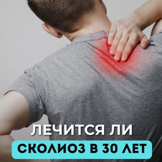 Лечится ли сколиоз в 30 лет? Разбираем правду и мифы!