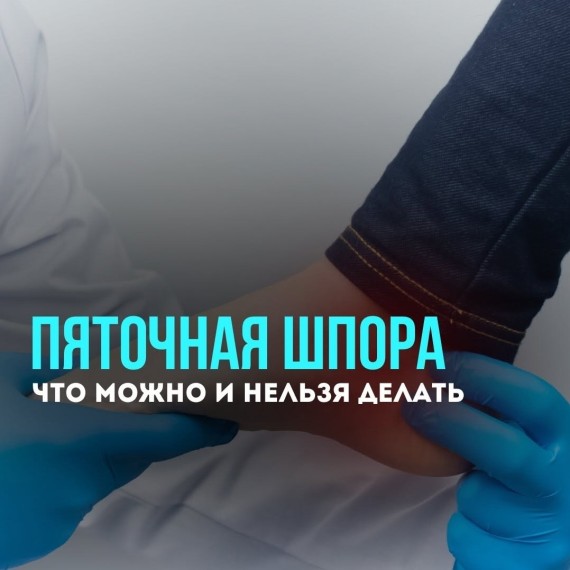 Пяточная шпора — это не приговор, если знать, что можно, а что строго нельзя делать!