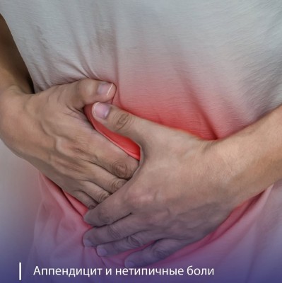 Классический симптом аппендицита