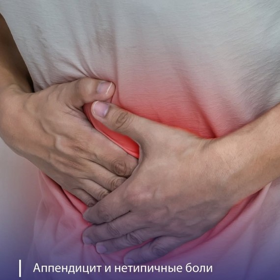 Классический симптом аппендицита
