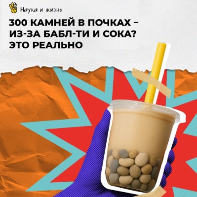 300 камней в почках из-за бабл-ти: случай из Тайваня