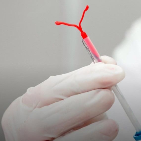 Самый надежный метод контрацепции