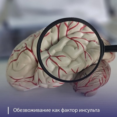 Обезвоживание как фактор инсульта