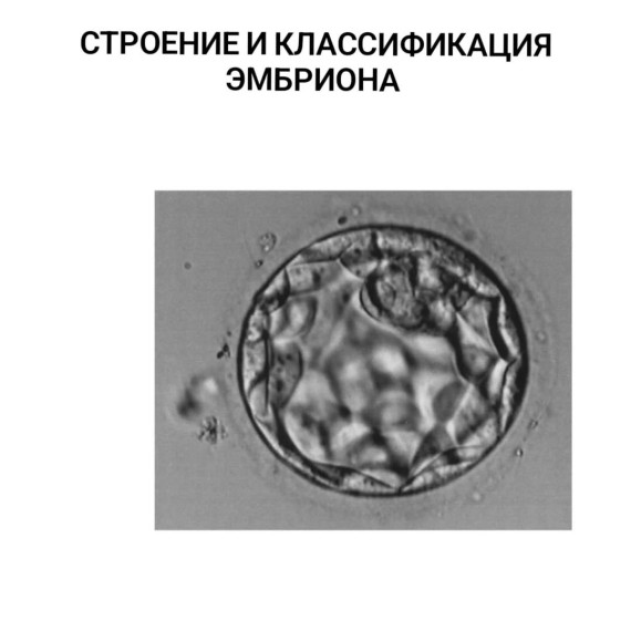 Строение и классификация эмбриона