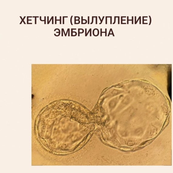 Хетчинг (вылупление) эмбриона