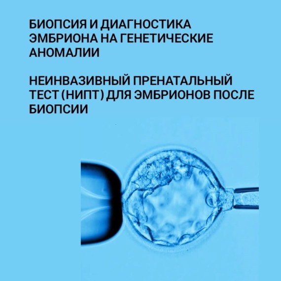 Как проводится биопсия эмбриона?