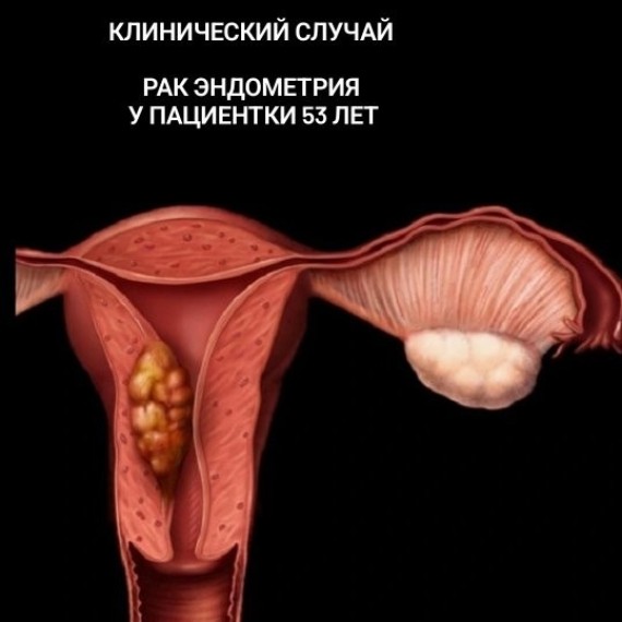 Кровянистые выделения в менопаузе — симптом, который нельзя игнорировать