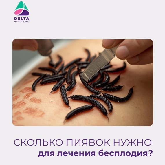 Сколько пиявок нужно, чтобы вылечить бесплодие?
