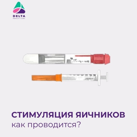 Стимуляция яичников при ЭКО как проводится?