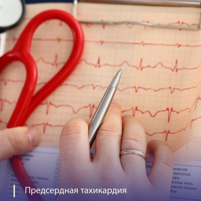 Что такое предсердная тахикардия?