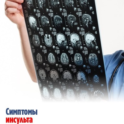 Симптомы инсульта