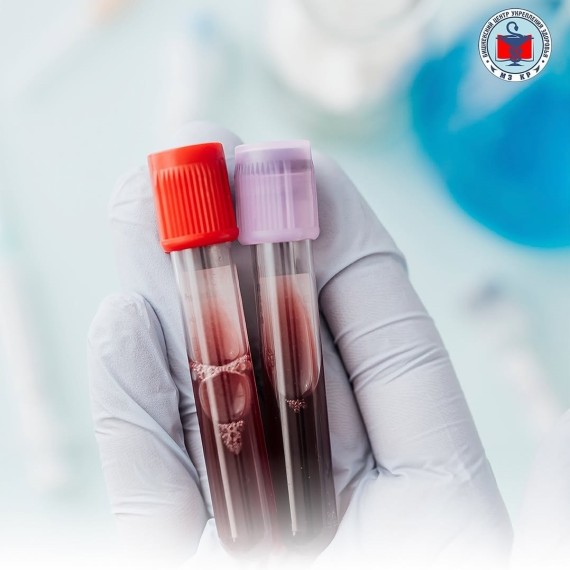 Анемия: симптомы, лечение