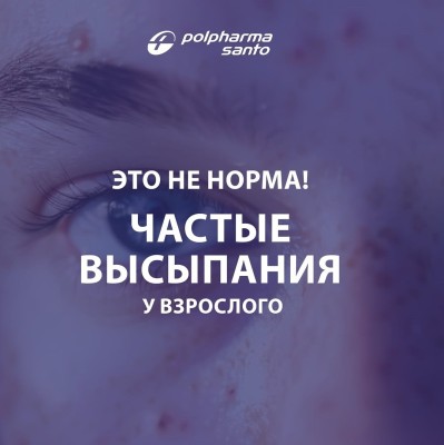 Частые высыпания у взрослого. Это не норма!
