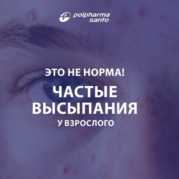 Частые высыпания у взрослого. Это не норма!