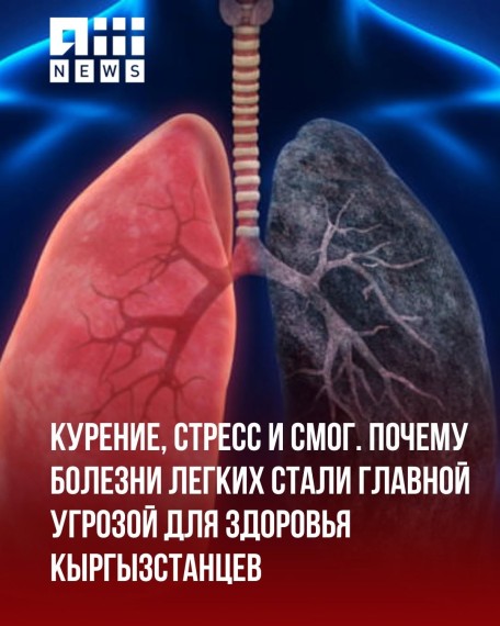 Курение, стресс и смог. Почему болезни легких стали главной угрозой для здоровья кыргызстанцев